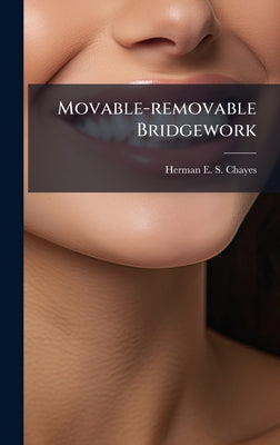 Movable-removable Bridgework by Herman E S Chayes book cover