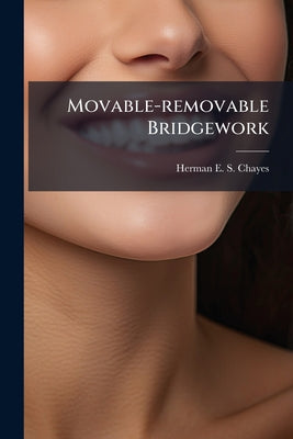 Movable-removable Bridgework by Herman E S Chayes book cover