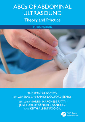 ABCs of Abdominal Ultrasound: Theory and Practice by Mart Marchese Ratti book cover