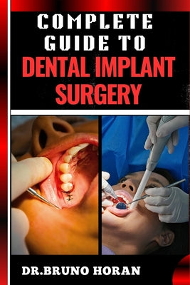 Complete Guide to Dental Implant Surgery: Comprehensive Manual To Advanced Techniques, Recovery, and Best Practices for Optimal Oral Health by Bruno Horan book cover