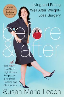 Book cover of Before & After, Revised Edition (Revised) by Leach, Susan Maria