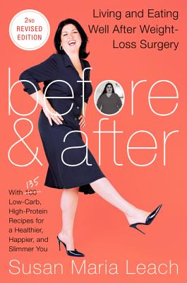 Book cover of Before & After, Second Revised Edition: Living and Eating Well After Weight-Loss Surgery by Leach, Susan Maria