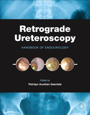 Book cover of Retrograde Ureteroscopy: Handbook of Endourology by Geavlete, Petrisor Aurelian