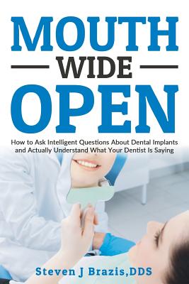 Mouth Wide Open: How To Ask Intelligent Questions About Dental Implants and Actually Understand What Your Dentist Is Saying by Steven J. Brazis Dds book cover