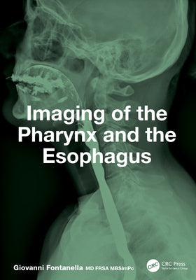 Imaging of the Pharynx and the Esophagus by Giovanni Fontanella book cover