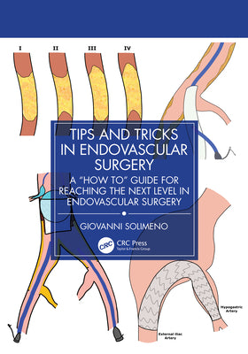 Tips and Tricks in Endovascular Surgery: A "How to" Guide for reaching the next Level in Endovascular Surgery by Giovanni Solimeno book cover