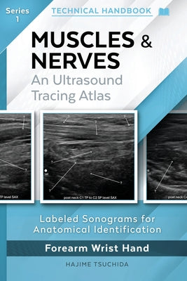 MUSCLES & NERVES - Technical Ultrasound Handbook of the Forearm, Wrist and Hand (Series 1): An Ultrasound Tracing Atlas by Hajime Tsuchida book cover
