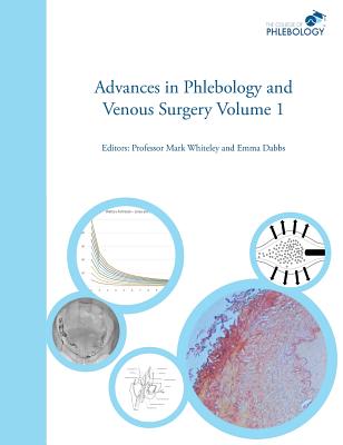 Advances in Phlebology and Venous Surgery Volume 1 by Mark S. Whiteley book cover