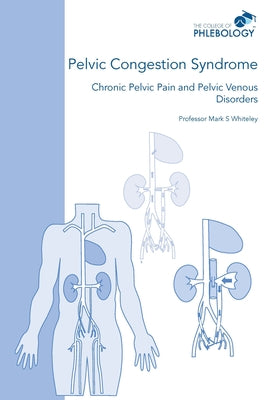Pelvic Congestion Syndrome - Chronic Pelvic Pain and Pelvic Venous Disorders by Mark S. Whiteley book cover