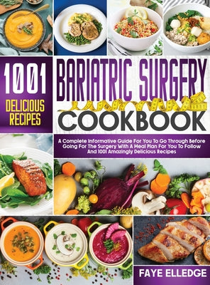 Bariatric Surgery Cookbook: A Complete Informative Guide for You to Go Through Before Going for the Surgery With a Meal Plan For You to Follow and 100 by Faye Elledge book cover