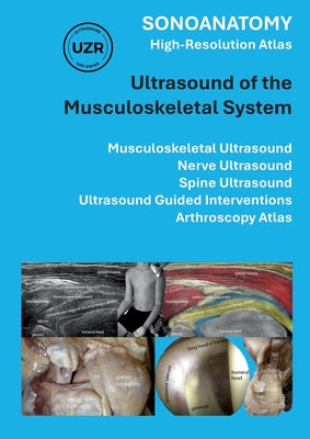 Sonoanatomy - High-Resolution Atlas - Ultrasound of the Musculoskeletal System: Musculoskeletal Ultrasound, Nerve Ultrasound, Spine Ultrasound, Ultras by Giorgio Tamborrini book cover