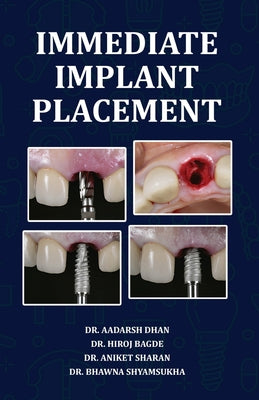 Immediate Implant Placement by Aadarsh Dhan book cover