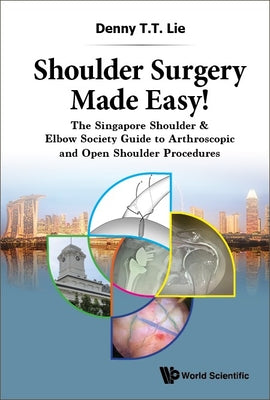 Book cover of Shoulder Surgery Made Easy! by Lie Denny T T