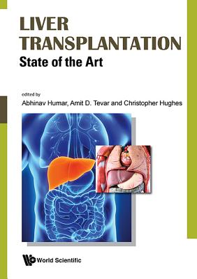 Book cover of Liver Transplantation: State of the Art by Humar Abhinav