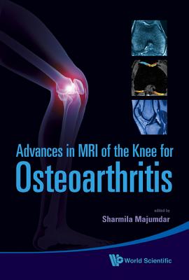 Book cover of Adv in MRI of the Knee for Osteoarthriti by Majumdar Sharmila