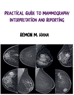 Practical Guide to Mammography Interpretation and Reporting by Remon M. Hana book cover