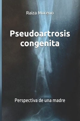 Pseudoartrosis congenita: Perspectiva de una madre by Raiza Moreno book cover