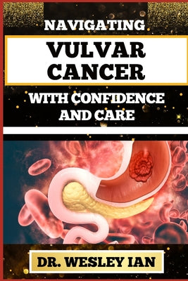 Navigating Vulvar Cancer with Confidence and Care: Empowering Insights And Strategies For Confronting Cancer Health Challenges For Female Genitals Rec by Wesley Ian book cover